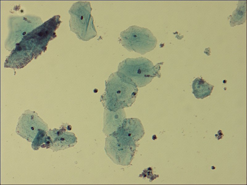 Microscopic view of Gardnerella vaginalis by Dr. F.C. Turner